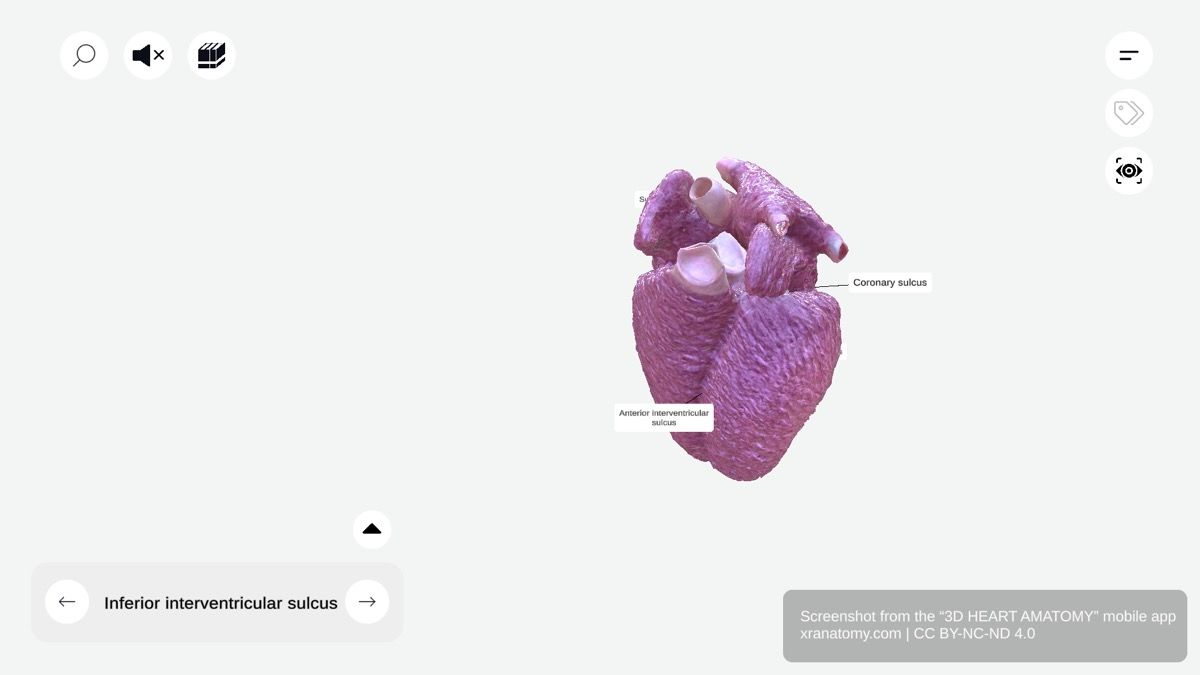 Heart sulci 360-degree viewer showing coronary sulcus, anterior and inferior interventricular sulci with coronary arteries and cardiac veins