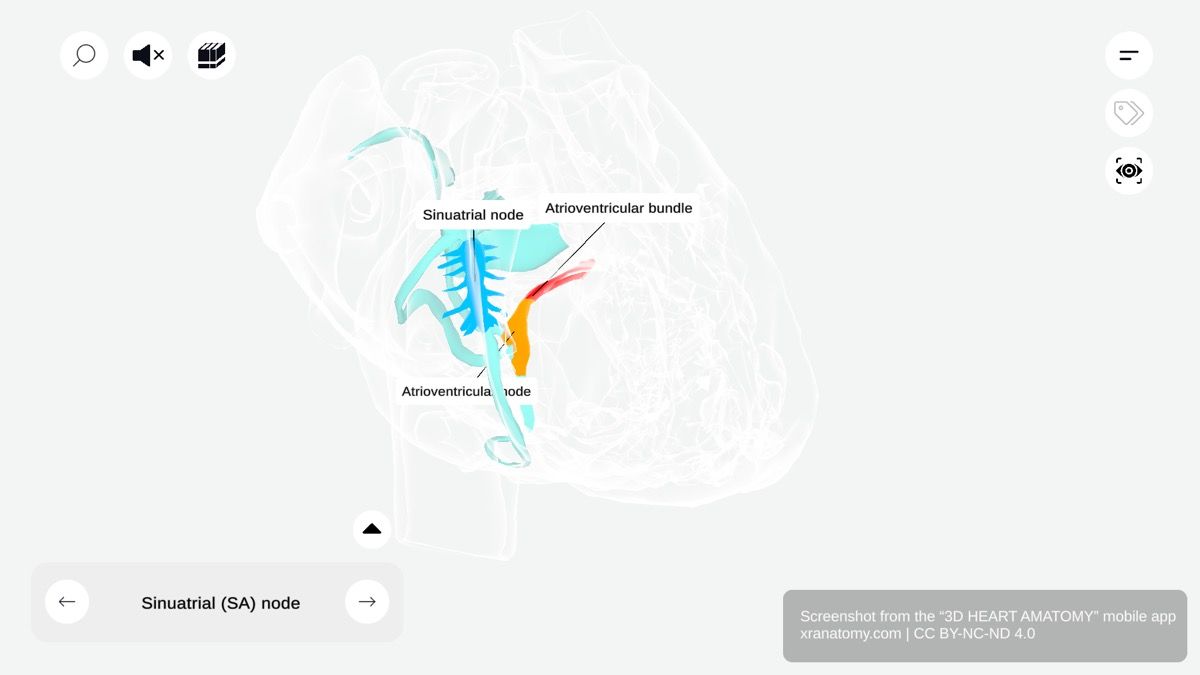 Sinoatrial node 360-degree viewer showing tadpole-shaped SA node in right atrium near superior vena cava opening within terminal groove