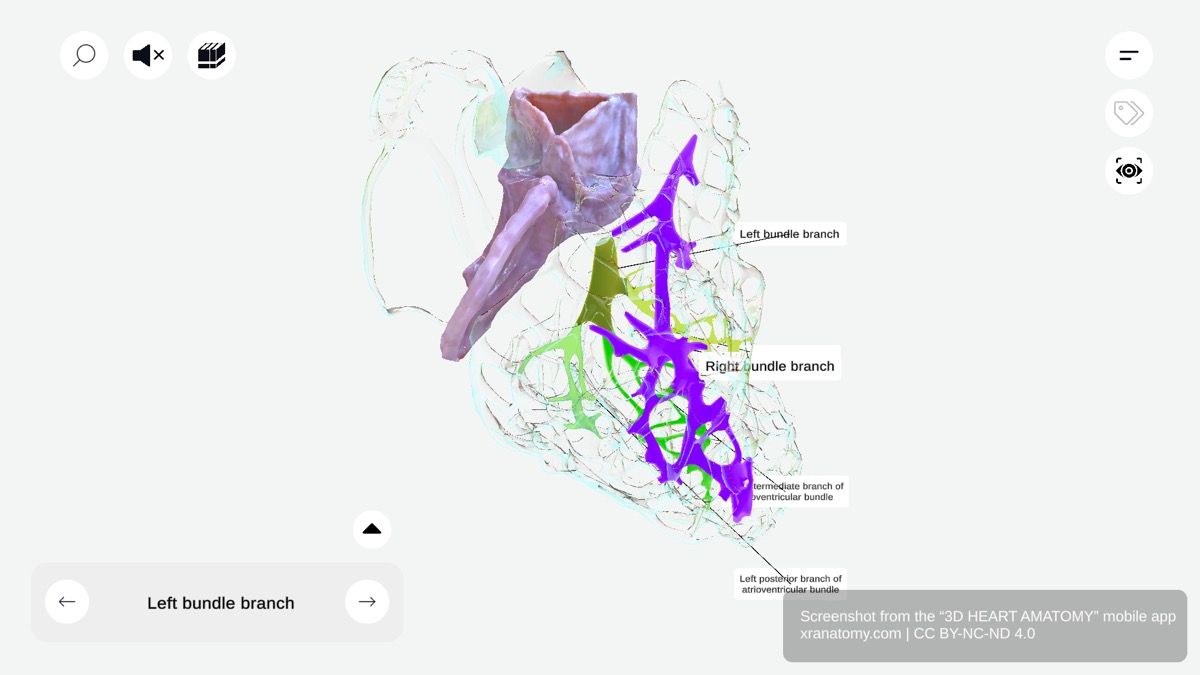 Left bundle branch 360-degree viewer showing conduction pathway with anterior, intermediate, and posterior fascicles toward left ventricle