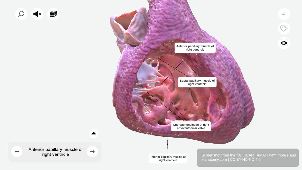 Tension apparatus 360-degree interactive viewer showing papillary muscles and chordae tendineae