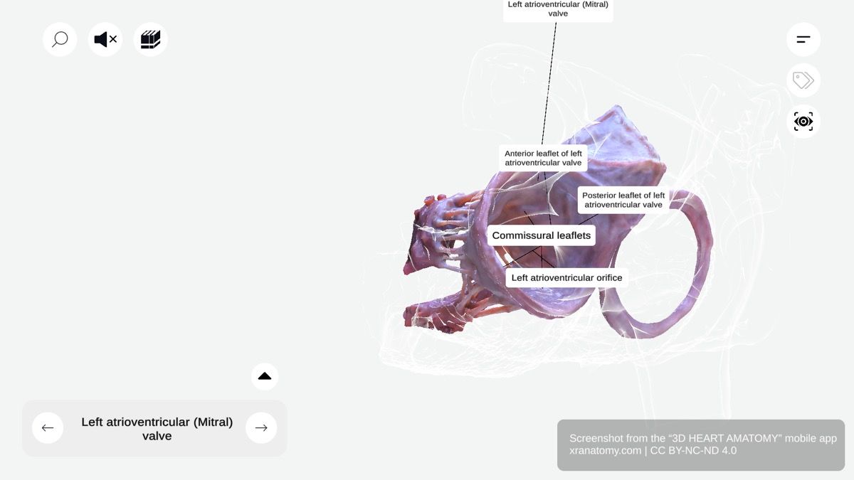 Mitral valve leaflets 360-degree interactive viewer showing anterior and posterior cusps