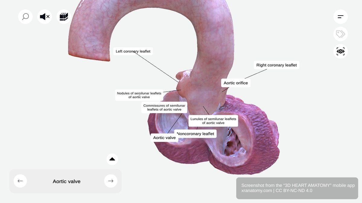 Root of aorta anatomy 360-degree interactive viewer showing aortic valve and left ventricular outflow tract