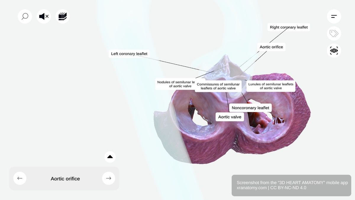 Aortic valve leaflets 360-degree interactive viewer showing right coronary, left coronary, and noncoronary leaflets