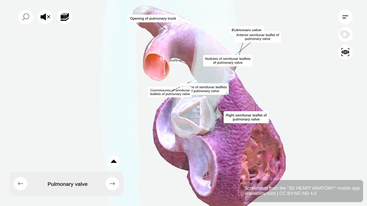 Root of pulmonary trunk anatomy 360-degree interactive viewer showing pulmonary valve and surrounding structures