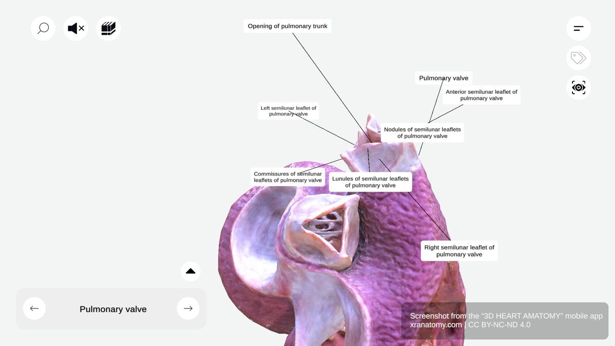 Pulmonary valve 360-degree interactive viewer showing semilunar valve between right ventricle and pulmonary artery