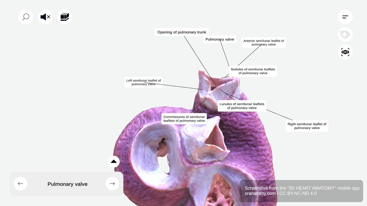 Pulmonary valve leaflets 360-degree interactive viewer showing right, left, and anterior semilunar leaflets