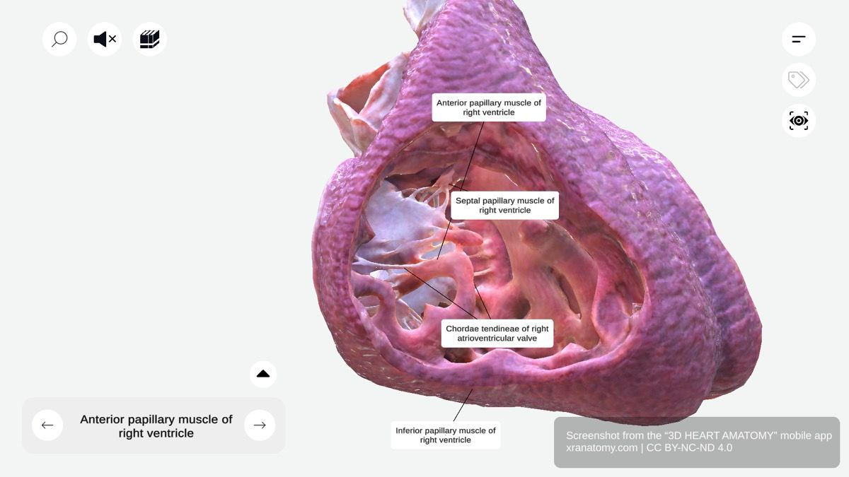 Papillary muscles of right ventricle 360-degree interactive viewer showing anterior, inferior, and septal papillary muscles