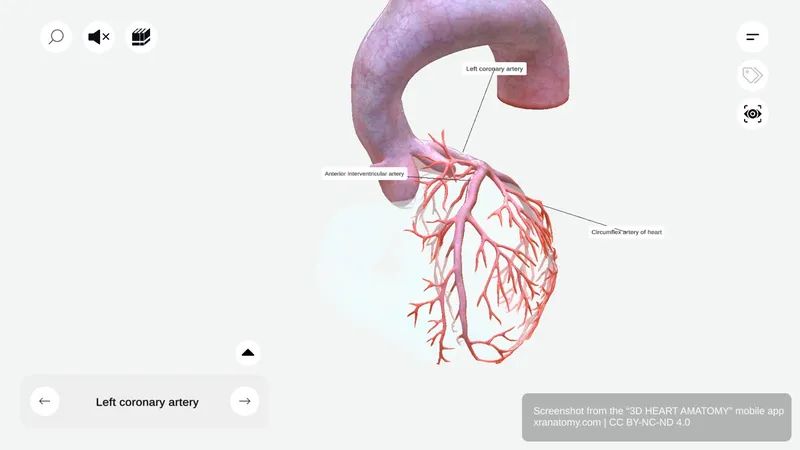 Left coronary artery anatomy 360-degree interactive viewer showing LCA origin from left aortic sinus and bifurcation