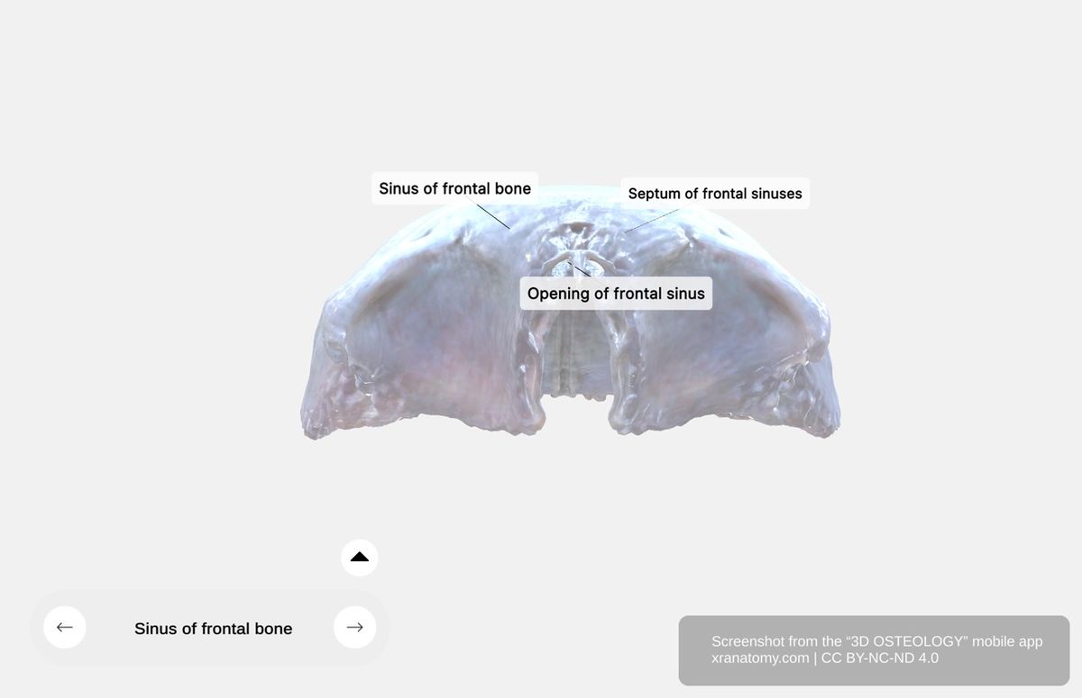 Frontal sinuses 360-degree viewer showing paired irregular cavities, septum of frontal sinuses, drainage openings, and position superior to orbits