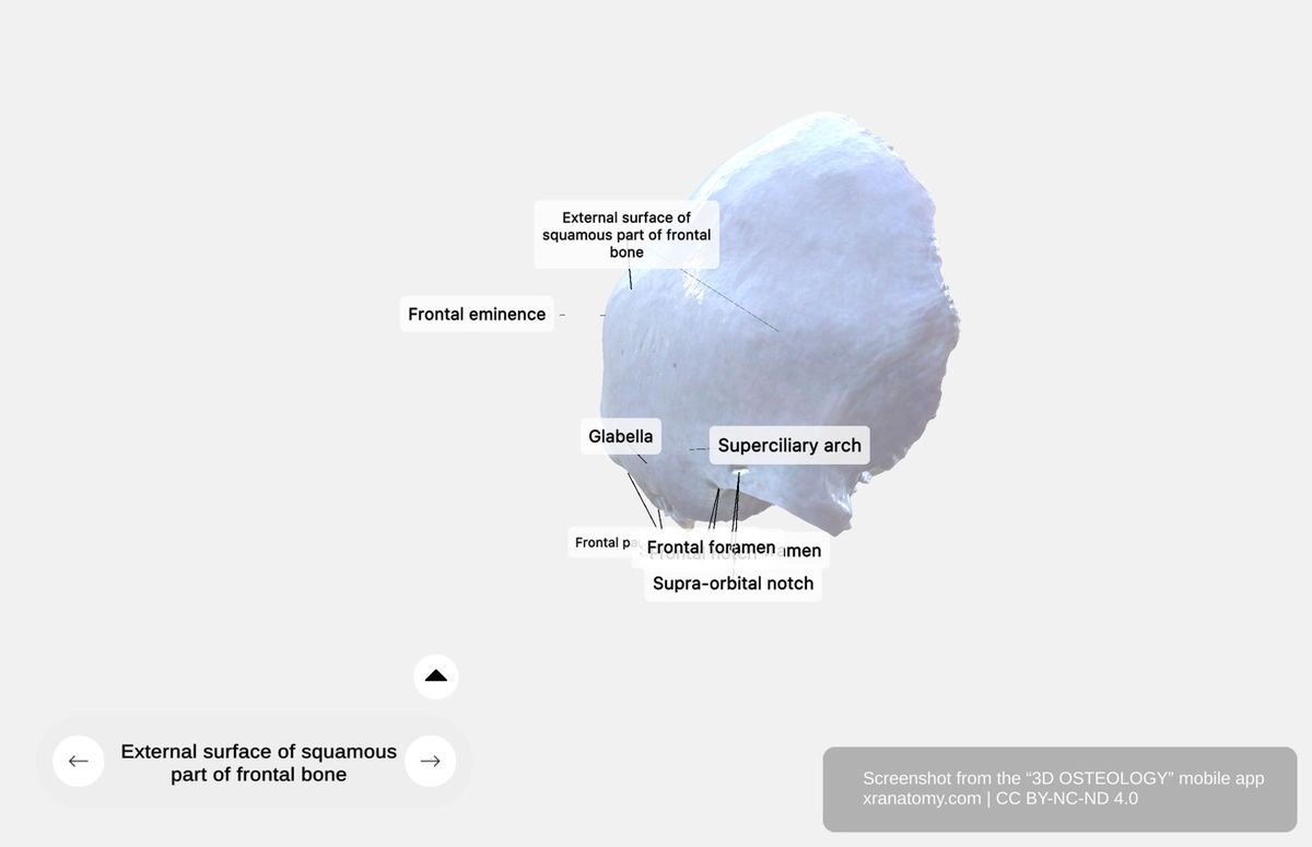 External surface of squamous part 360-degree viewer showing frontal eminences, superciliary arches, glabella, supraorbital margin, and forehead contour