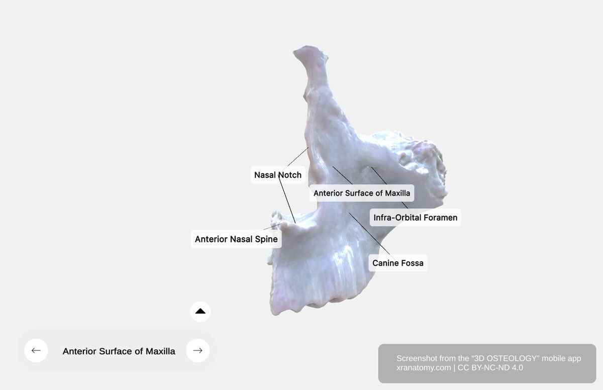Anterior surface of maxilla 360-degree viewer showing canine fossa, nasal notch, anterior nasal spine, and infraorbital foramen
