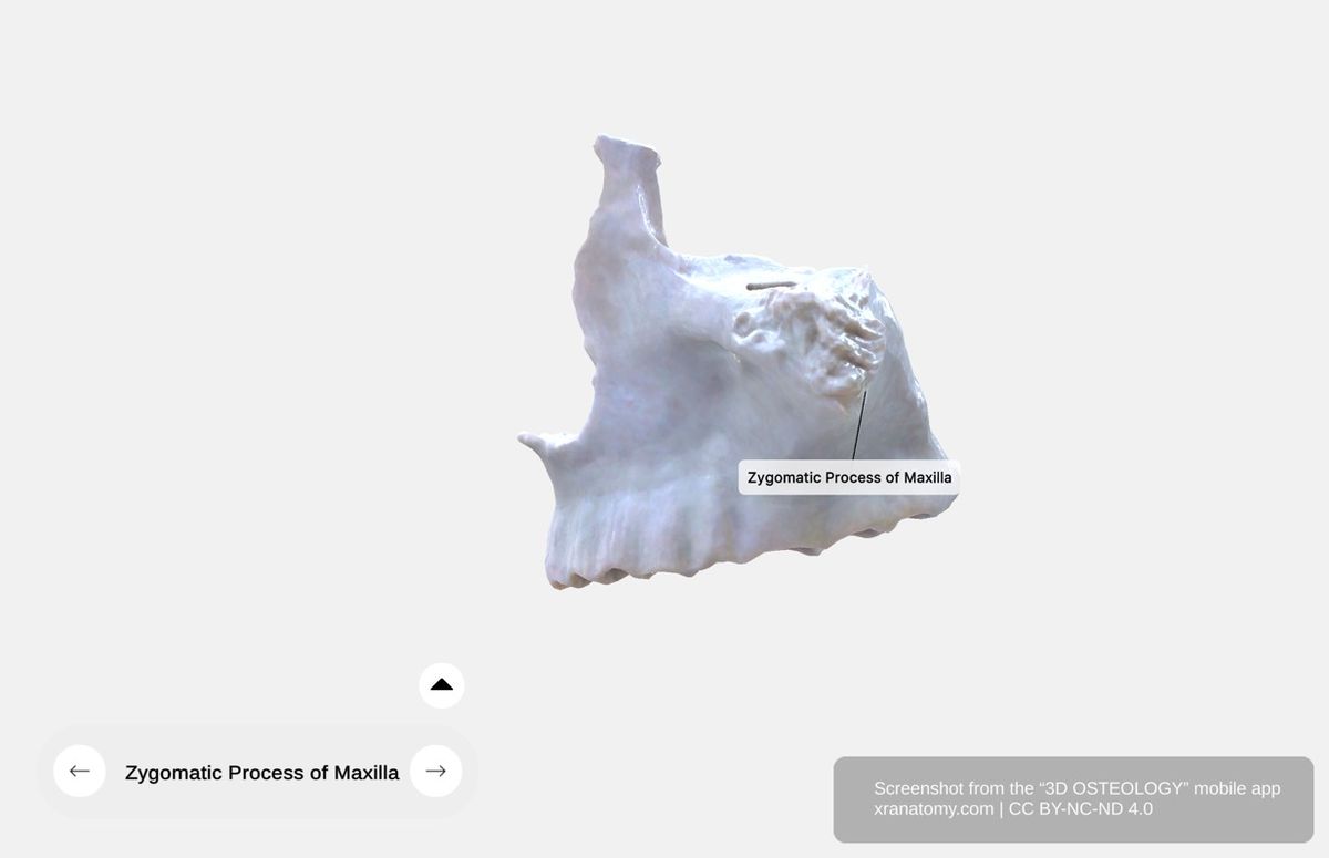 Zygomatic process of maxilla 360-degree viewer showing lateral projection articulating with zygomatic bone and contributing to infraorbital rim