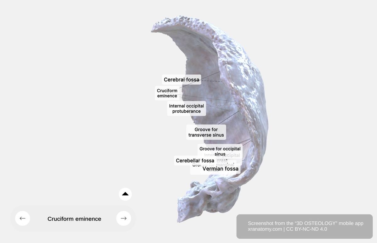 Internal surface of squamous part 360-degree viewer showing cruciform eminence, cerebral and cerebellar fossae, and venous sinus grooves
