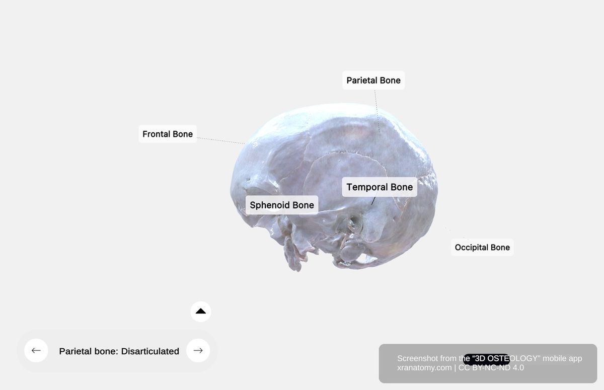 Parietal bone anatomy 360-degree interactive viewer showing articulations with frontal, occipital, temporal, and opposite parietal bones at cranial sutures