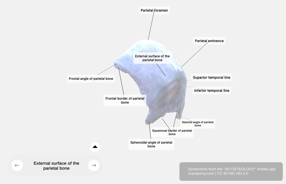 External surface of parietal bone 360-degree viewer showing parietal eminence, superior and inferior temporal lines, parietal foramen, and scalp foundation