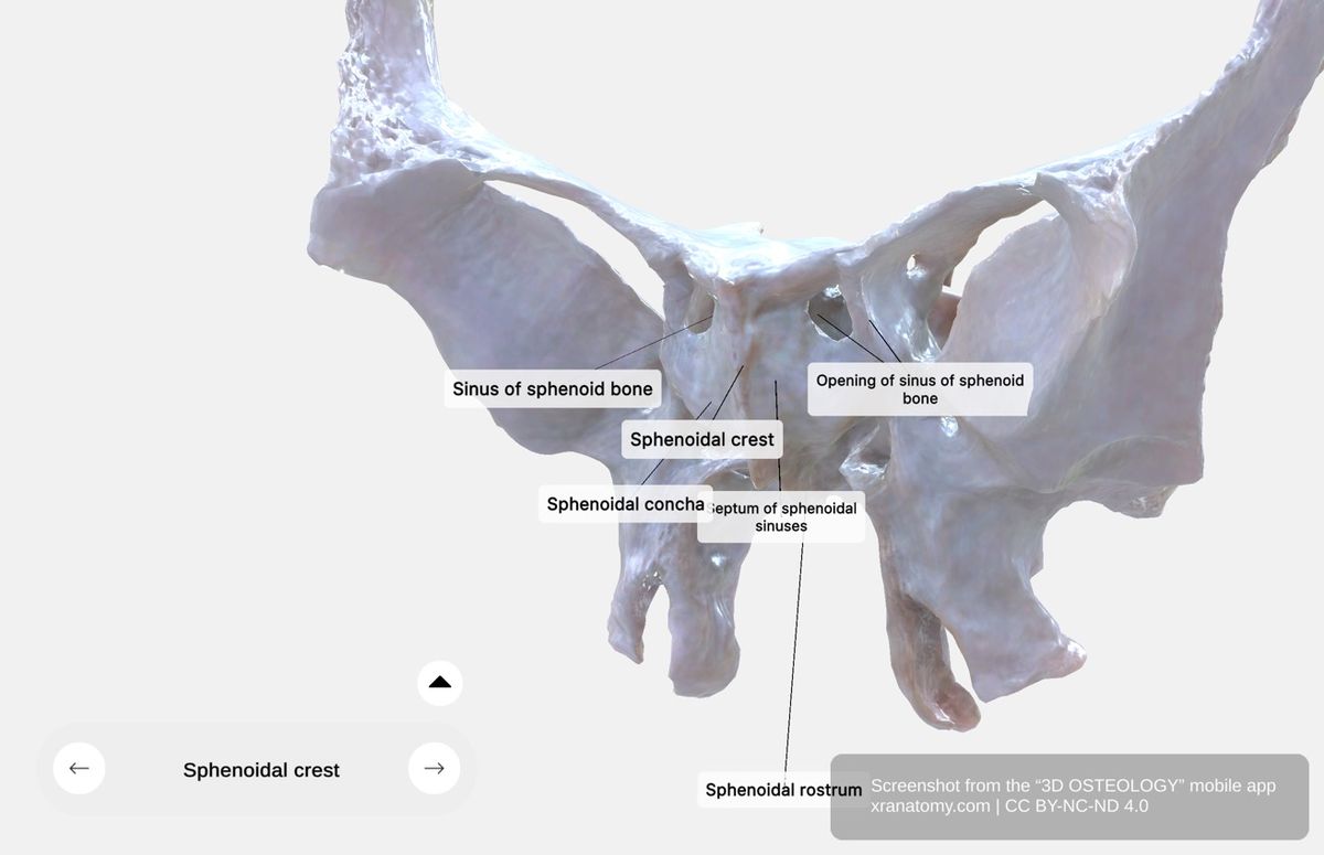 Anterior surface of sphenoid body 360-degree viewer showing sphenoidal crest, sphenoidal rostrum, and apertures of sphenoidal sinuses