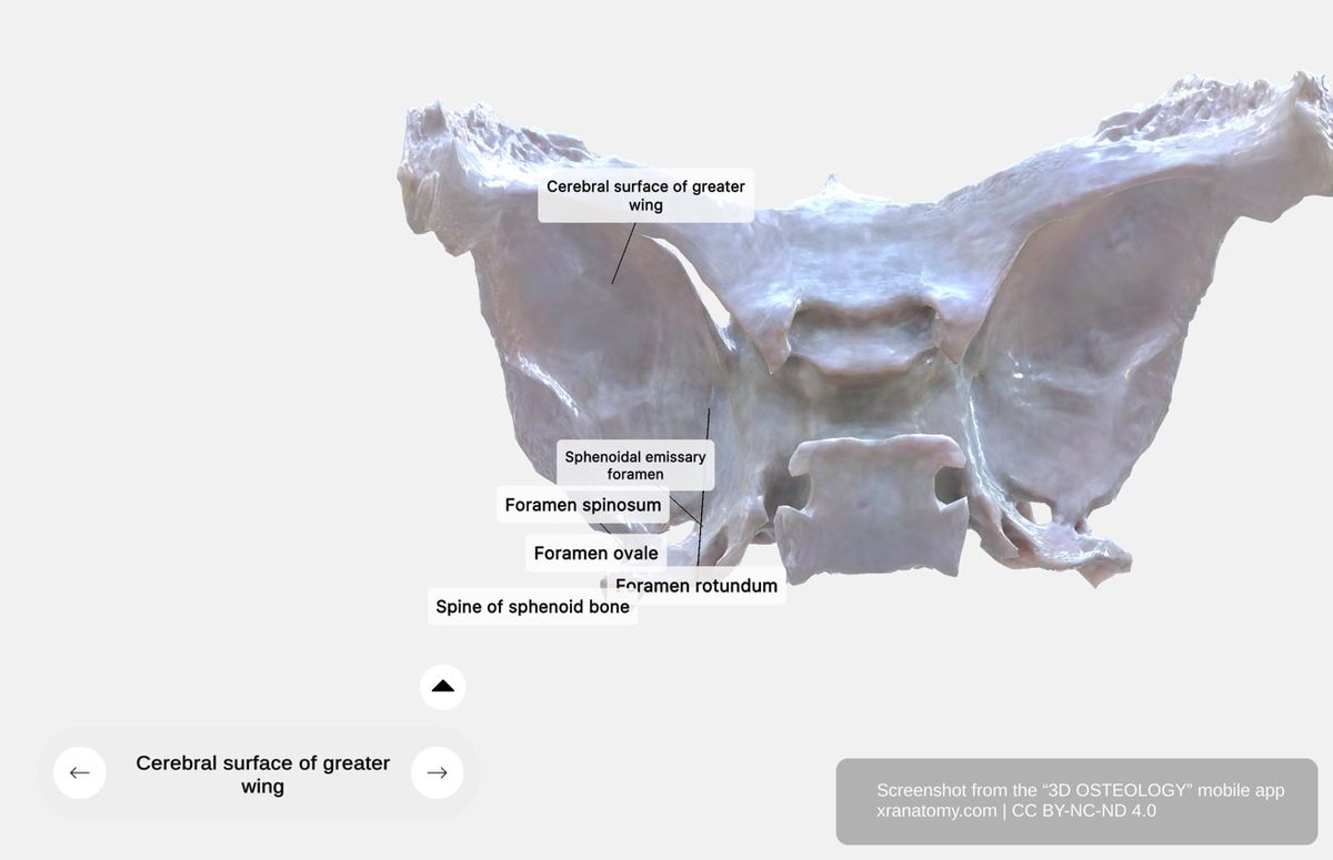Greater wing of sphenoid 360-degree viewer showing foramen rotundum, foramen ovale, foramen spinosum, and middle cranial fossa floor