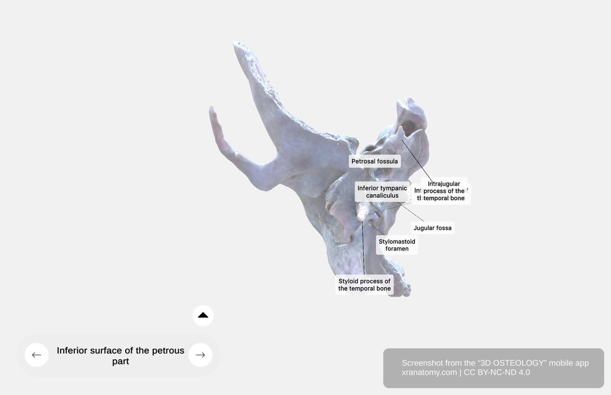 Inferior surface of petrous part 360-degree viewer showing carotid canal, jugular fossa, mastoid process, stylomastoid foramen, and styloid process