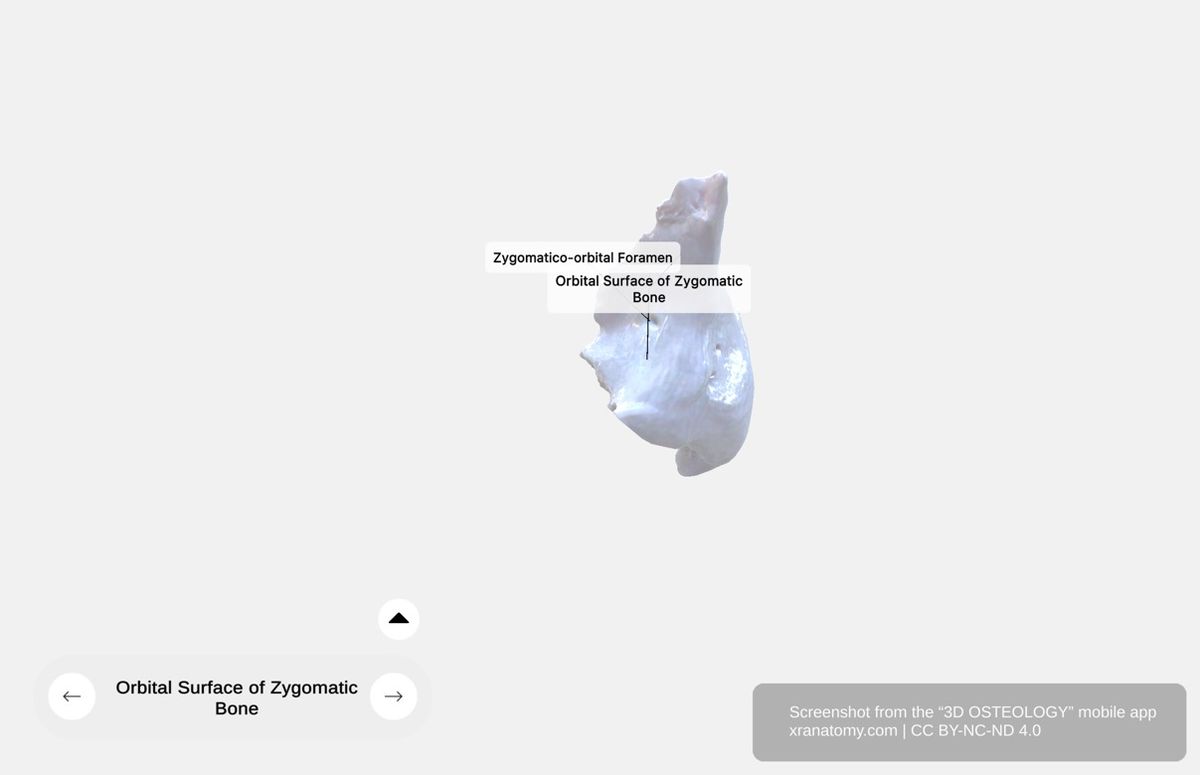 Zygomatic bone orbital surface 360-degree viewer showing lateral orbital wall contribution, orbital floor, zygomatico-orbital foramen, and smooth bony surface