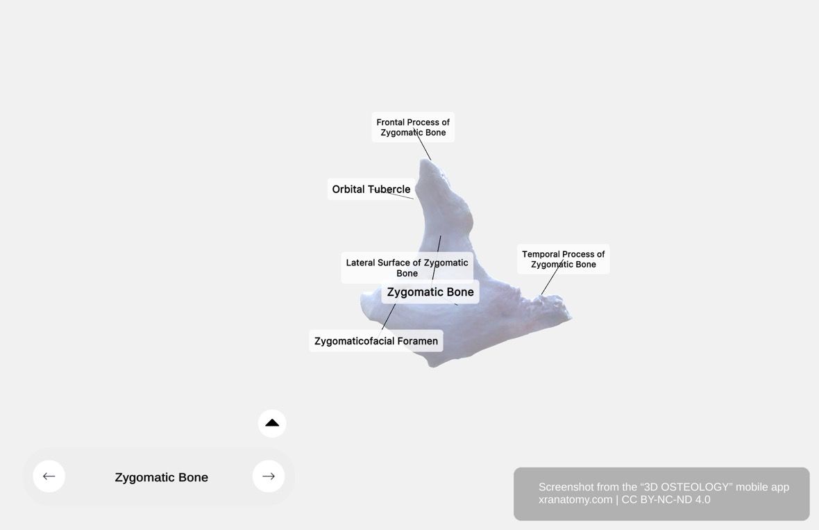 Zygomatic bone lateral surface 360-degree viewer showing convex external aspect, zygomaticofacial foramen, and cheek contour