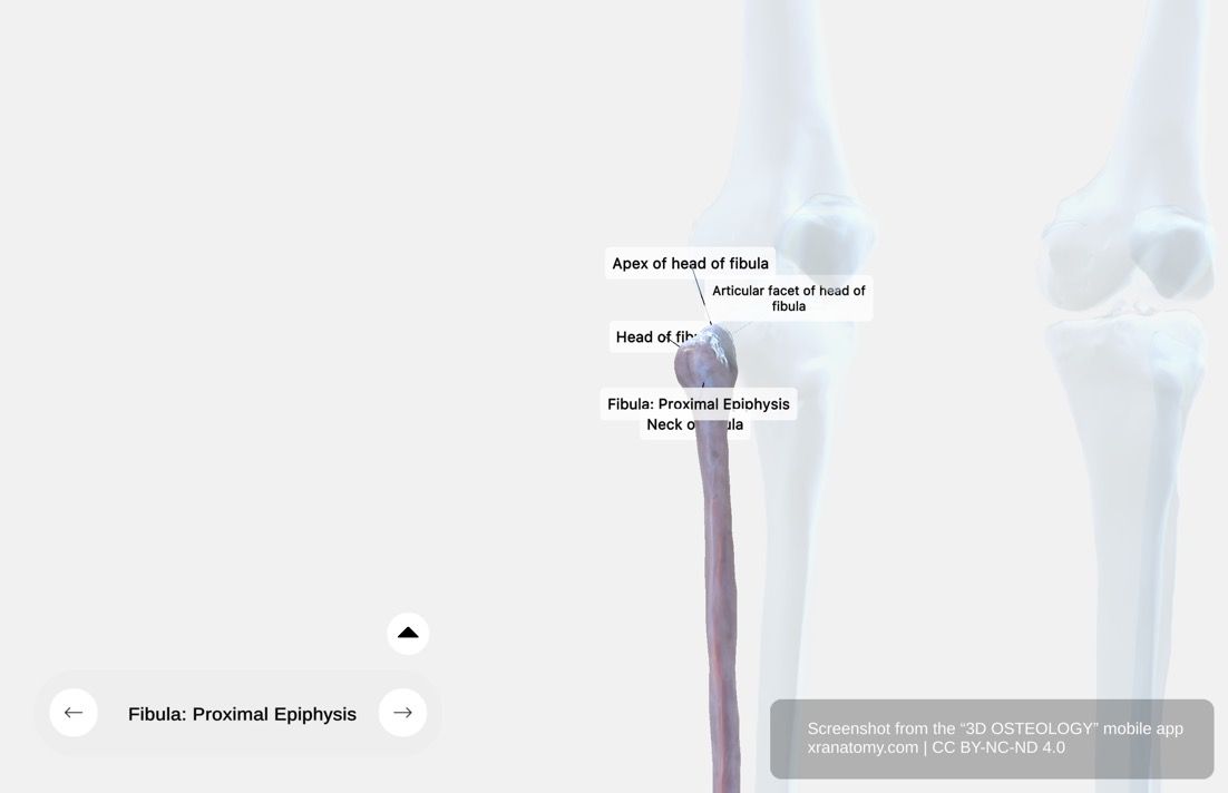 Fibula proximal epiphysis 360-degree viewer showing head of fibula, articular facet, apex (styloid process), and neck of fibula