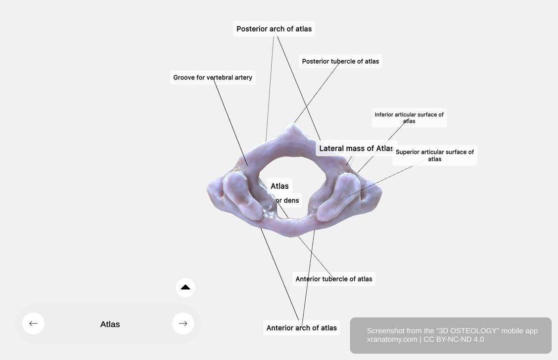Atlas lateral mass 360-degree viewer showing superior and inferior articular surfaces with weight-bearing structures