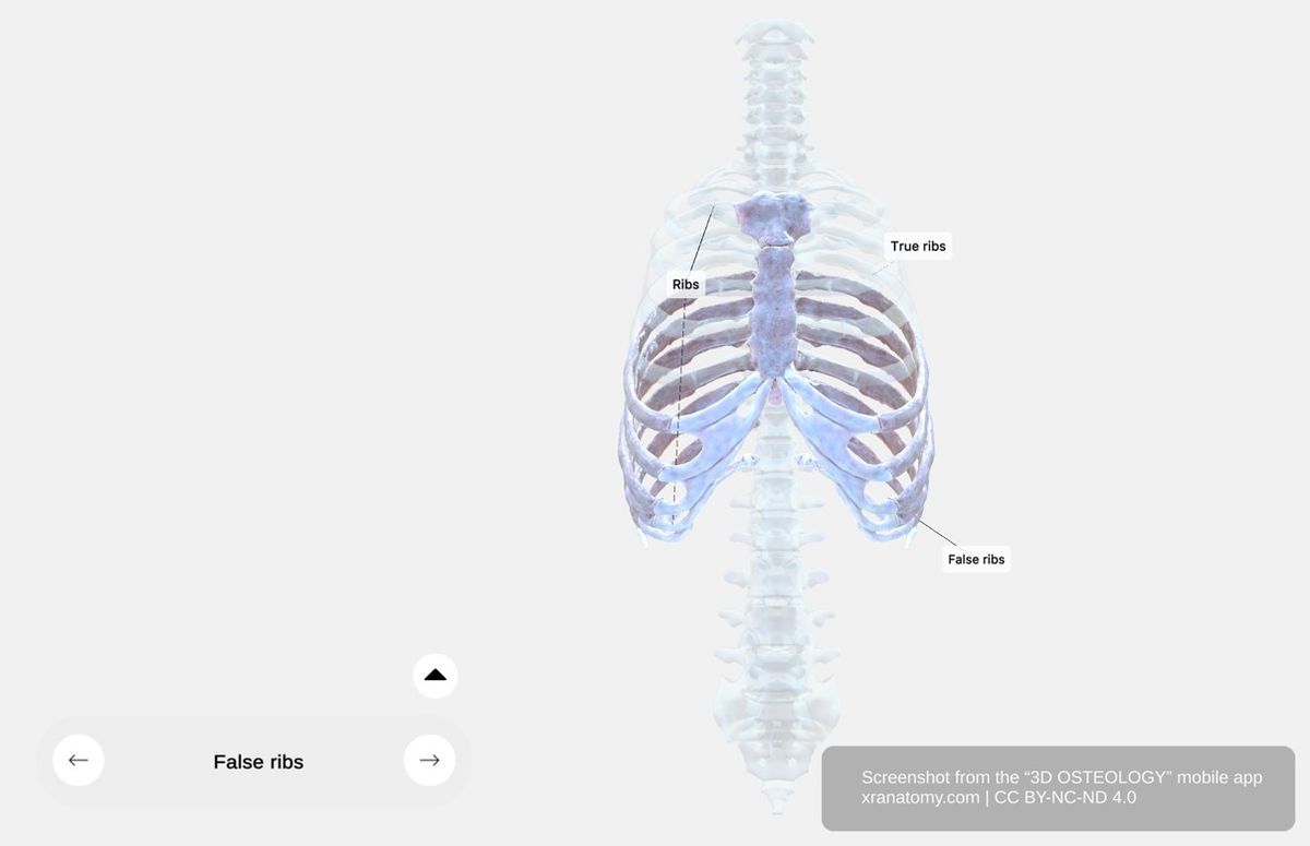False ribs 360-degree viewer showing ribs 8 through 12 without direct sternal attachment including vertebrochondral and floating ribs