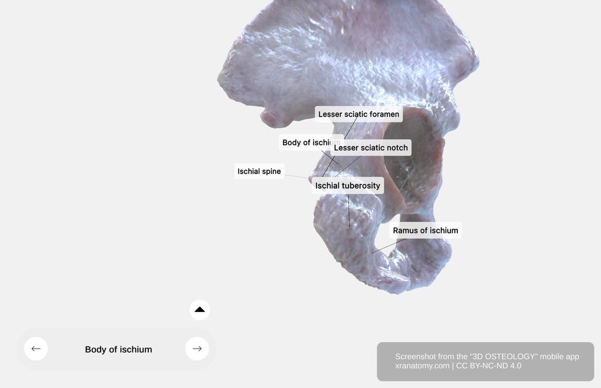 Ischium 360-degree viewer showing body, ramus, ischial tuberosity, ischial spine, and lesser sciatic notch