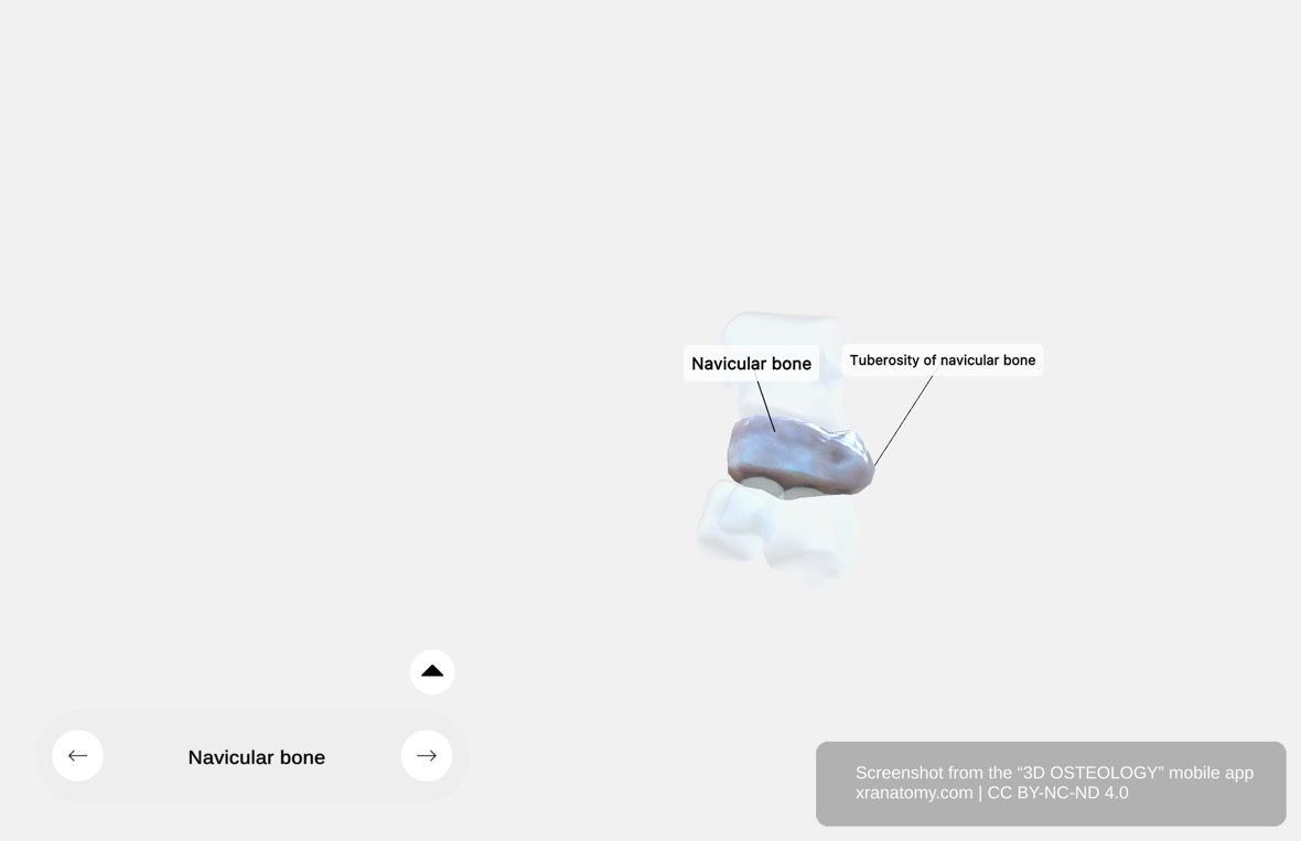 Navicular bone tuberosity 360-degree viewer showing the prominent medial surface projection, tibialis posterior insertion site, and groove between tuberosity and plantar process