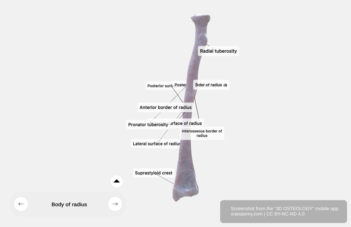 Body of radius 360-degree viewer showing radial tuberosity, anterior, posterior, and lateral surfaces, and interosseous border