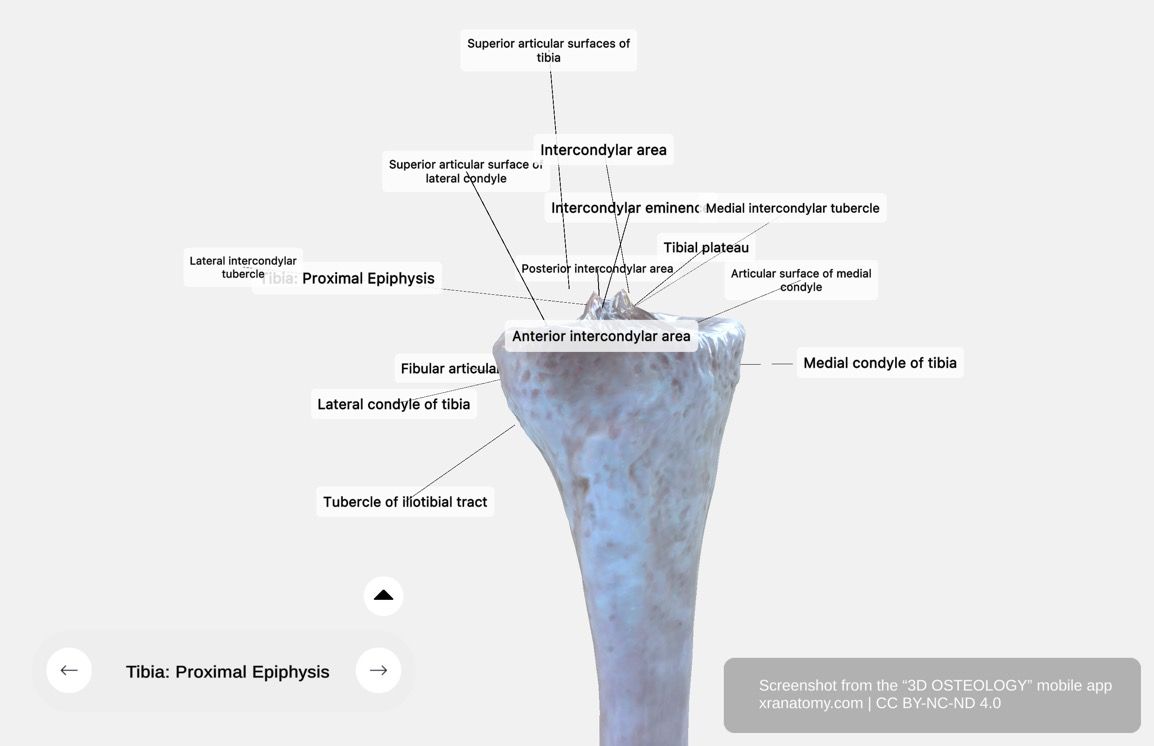 Tibia proximal epiphysis 360-degree viewer showing tibial plateau, medial and lateral condyles, intercondylar eminence, and fibular articular facet