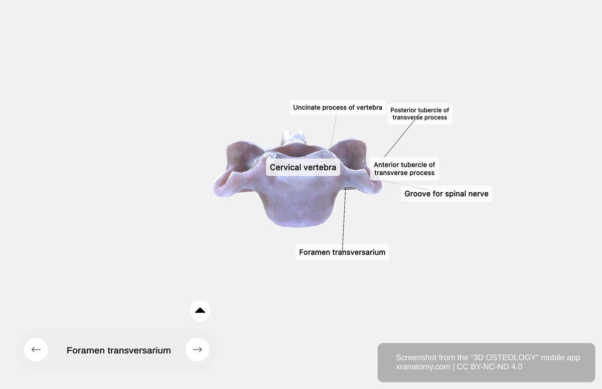 Cervical vertebra detailed 360-degree viewer showing vertebral body with uncinate processes, foramen transversarium, bifid spinous process, articular pillar, and anterior posterior tubercles
