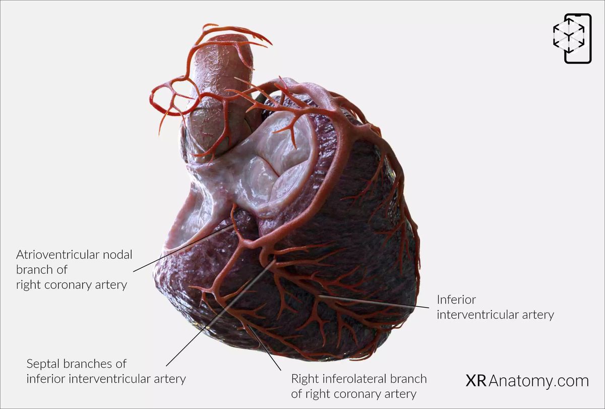 AR Figure 102 – Right coronary artery: AV Nodal branch
