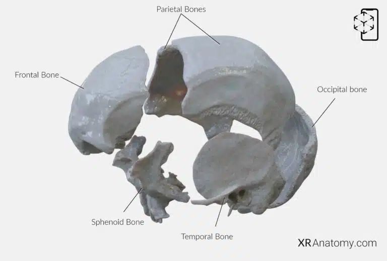 AR Figure 19 – Parietal Bone: Disarticulated view