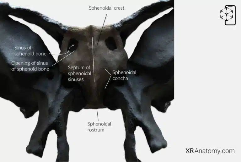 AR Figure 33 – Sphenoid Bone: Body of sphenoid bone