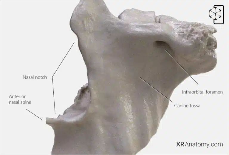 AR Figure 54 – Maxilla: Anterior Surface