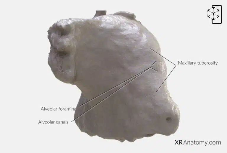 AR Figure 55 – Maxilla: Infratemporal surface of maxilla