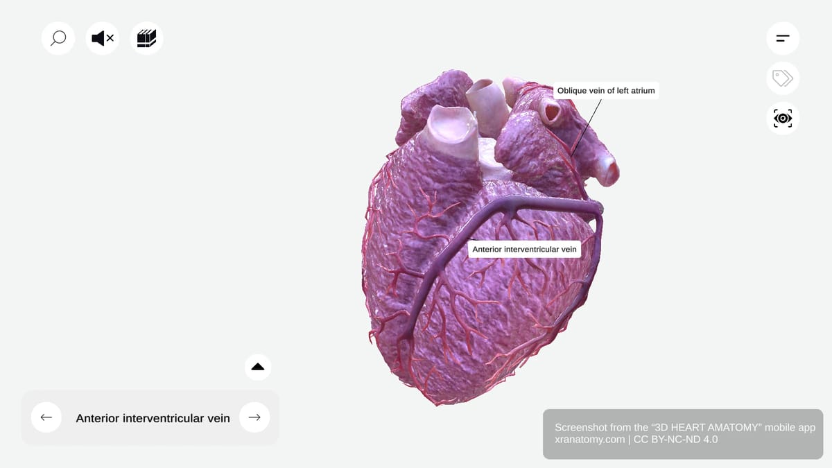 Anterior interventricular vein anatomy traveling in anterior interventricular groove with left anterior descending artery