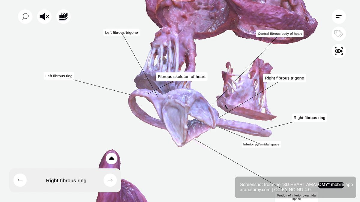Fibrous trigones of the heart showing right and left fibrous trigones between aortic and atrioventricular valves