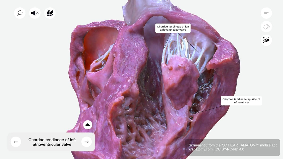 Chordae tendineae of left ventricle showing fibrous cords connecting papillary muscles to mitral valve leaflets
