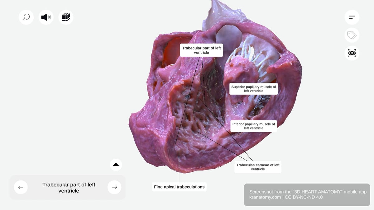 Papillary muscles of left ventricle showing superior and inferior papillary muscles