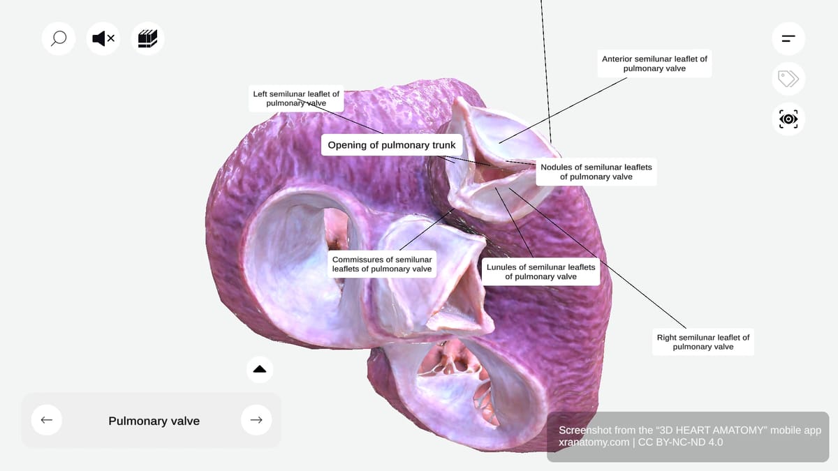 Opening of pulmonary trunk showing passage for blood ejection from right ventricle guarded by pulmonary valve
