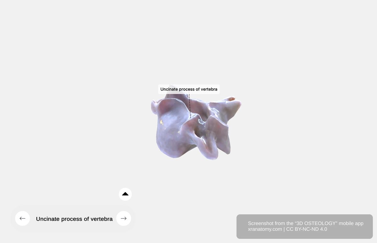 Uncinate process of cervical vertebra projecting upward from the superior surface of the vertebral body forming lateral boundary