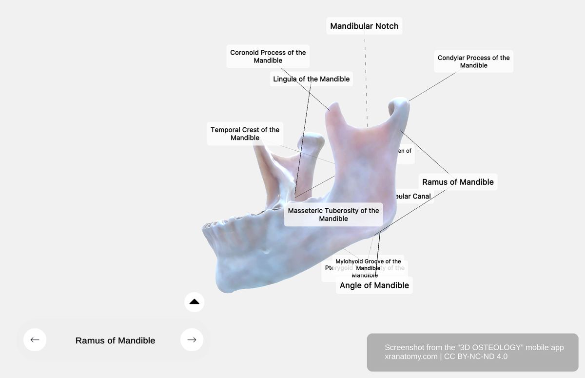 Lateral surface of mandible ramus showing masseteric tuberosity and masseter muscle attachment area