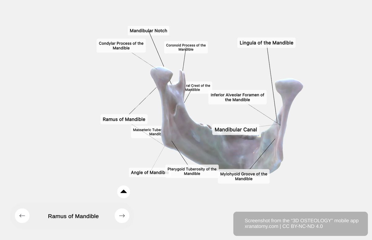 Medial surface of mandible ramus showing mandibular foramen, lingula, mylohyoid groove, and pterygoid tuberosity