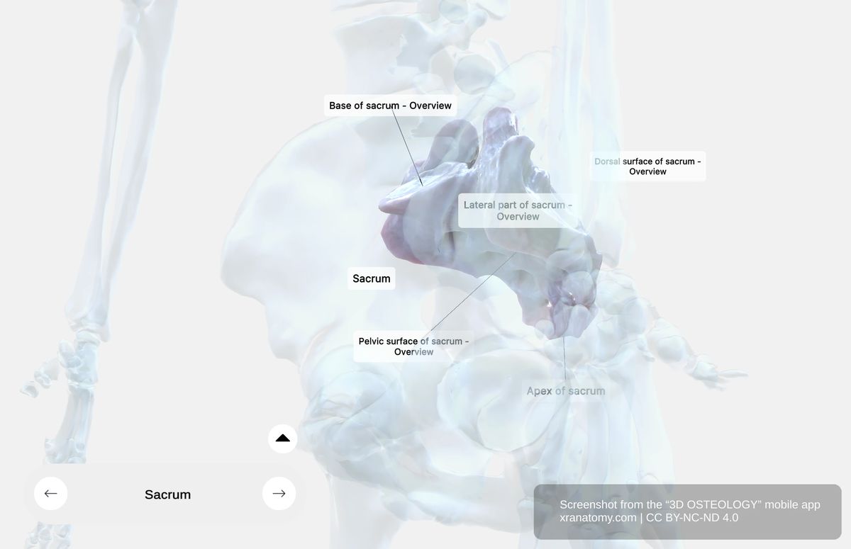 Lateral view of the sacrum showing auricular surface and sacral tuberosity