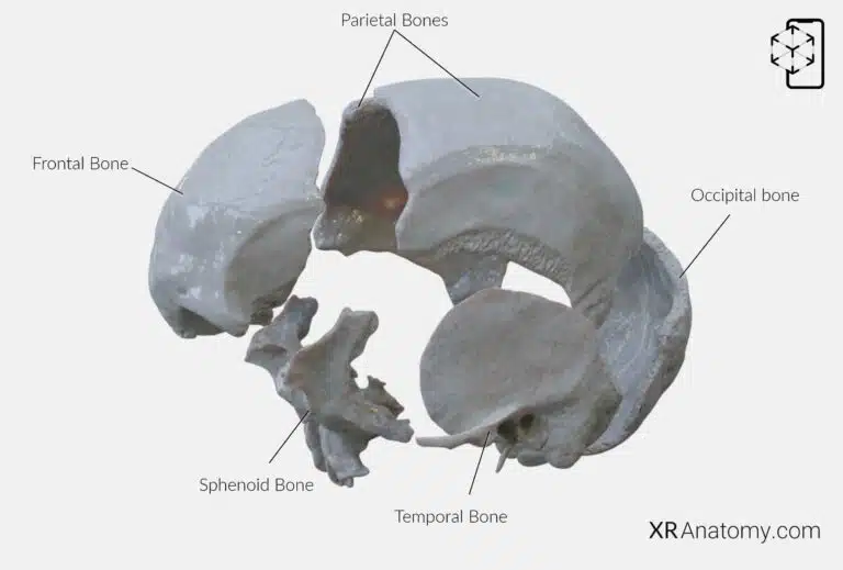 AR Figure 19 – Parietal Bone: Disarticulated view