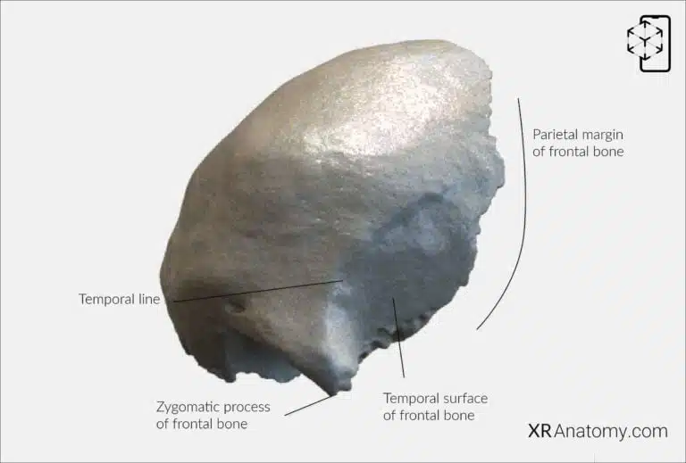 AR Figure 25 – Frontal Bone: Temporal surface