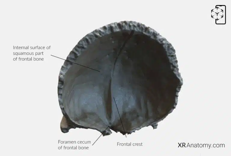 AR Figure 26 – Frontal Bone: Internal surface