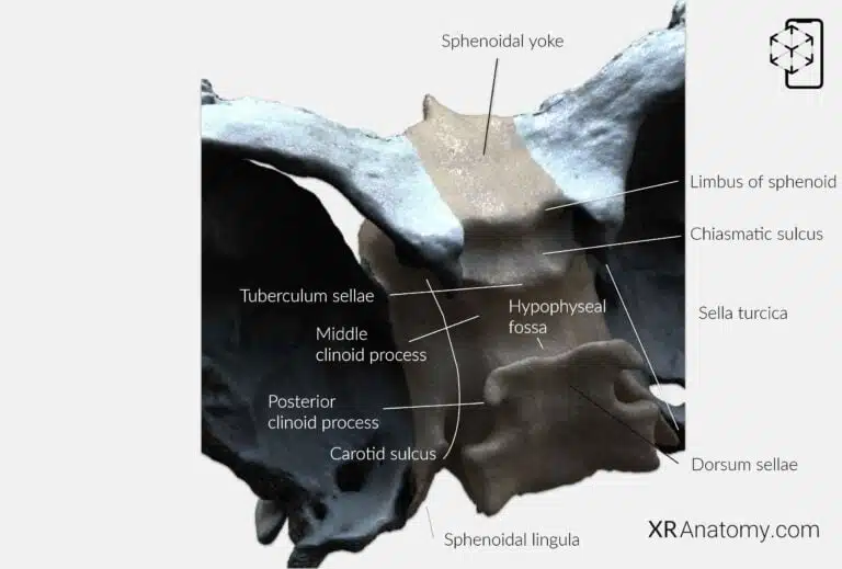 AR Figure 32 – Sphenoid Bone: Body of sphenoid bone